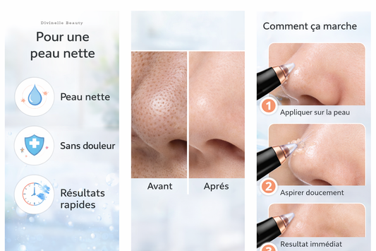 aspirateur points noirs nettoyage pores visage