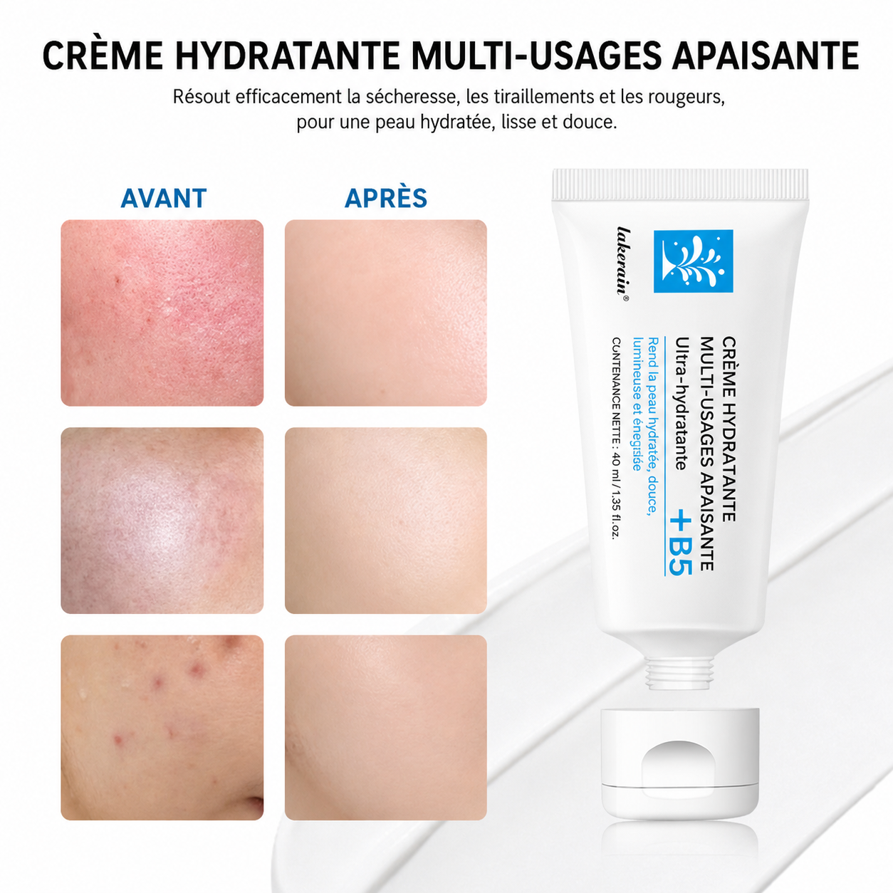 Crème visage B5 – Hydratation intense pour peau sèche