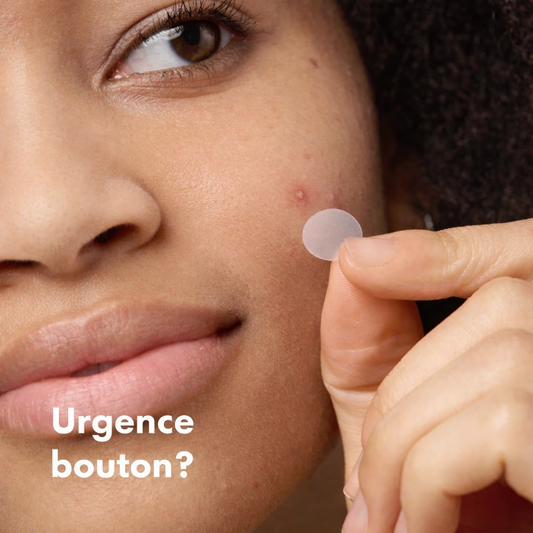 Femme utilisant un patch hydrocolloïde AcnéClear pour une urgence bouton.