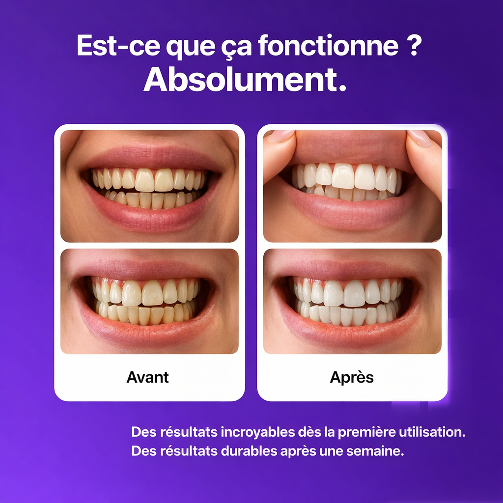 Résultat éclatant avec le kit de blanchiment des dents sans peroxyde pour dents sensibles