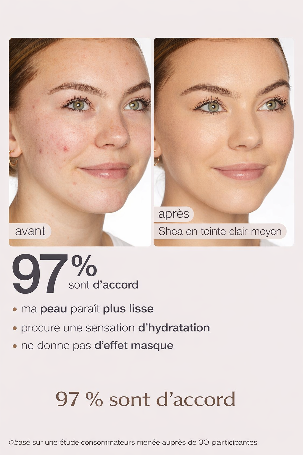 Avant après BB Crème hydratante réduction imperfections et rougeurs
